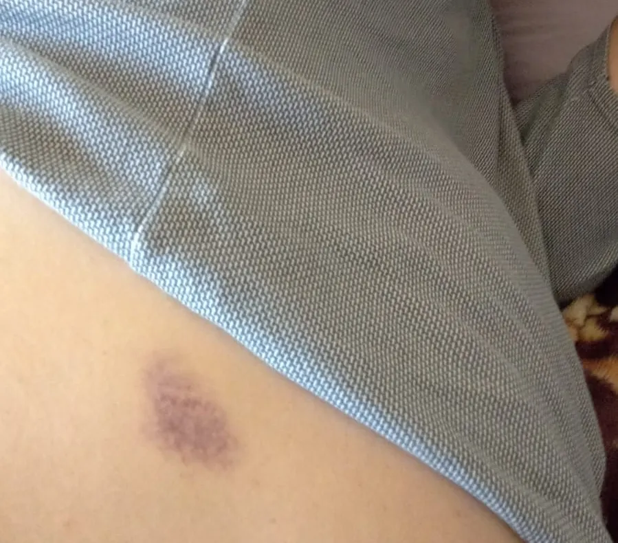 Fiica unui pacient care ar fi încercat să se arunce de la etaj acuză reprezentanții Spitalului Județean Focșani
