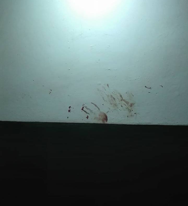 Femeie bătută de fostul soț, la Focșani