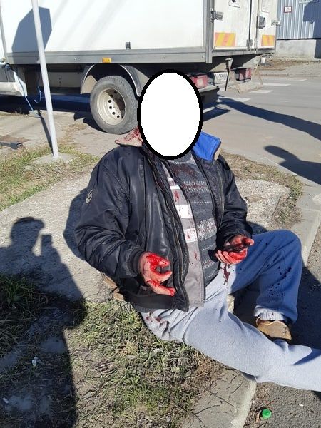 ULTIMA ORĂ A apărat un câine de hingheri iar aceștia i-au dat cu bâta-n cap