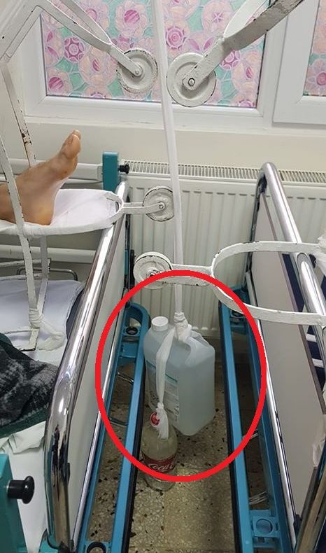 REVOLTĂTOR: Contrabalanță din bidon cu apă, la Spitalul din Focșani. DSP s-a autosesizat