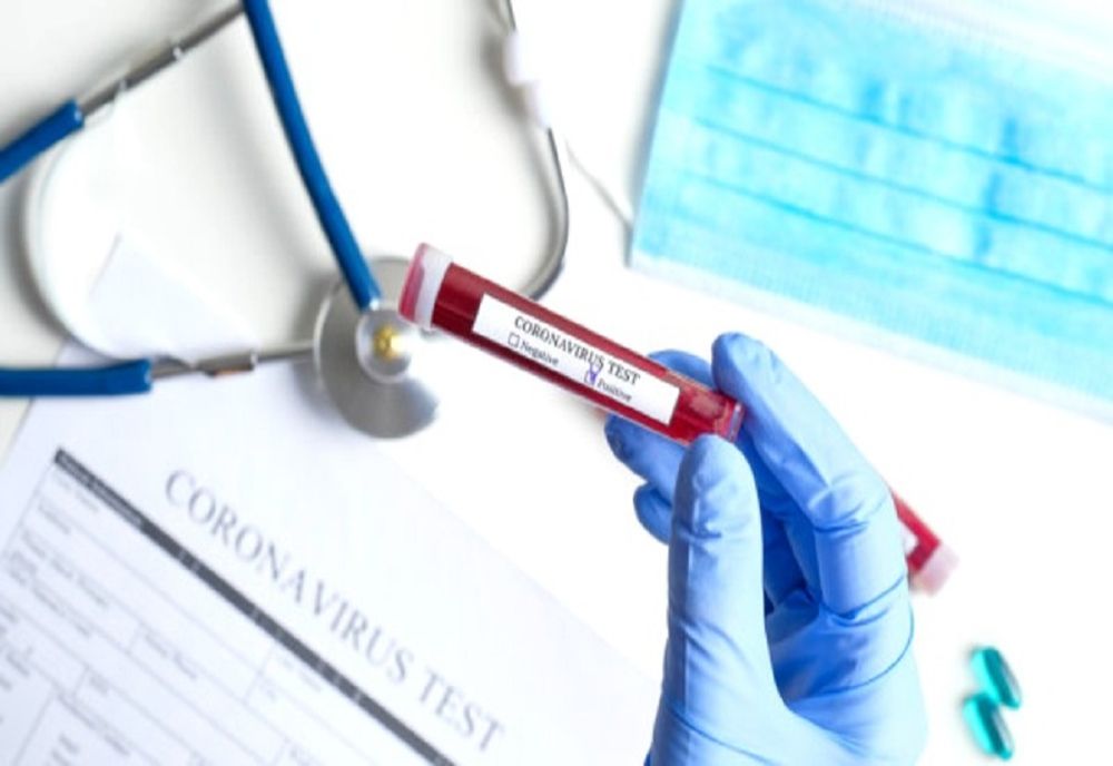 Bilanțul total al infectărilor a trecut de 60.000 la nivel național