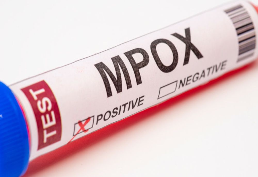 MPOX/ APROAPE UN MILION DE DOZE DE VACCIN AŞTEPTATE ÎN AFRICA